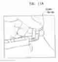 Fig. 15 - Endourethral device & method