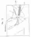 Fig. 16 - Endourethral device & method