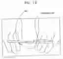 Fig. 17 - Endourethral device & method