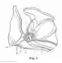 Fig. 02 - Transobturator methods for installing sling to treat incontinence, and related devices
