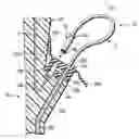 Fig. 01 - Endoscope accessory, endoscope system and method for mounting endoscope accessory to endoscope