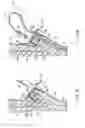 Fig. 03 - Endoscope accessory, endoscope system and method for mounting endoscope accessory to endoscope