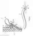 Fig. 04 - Endoscope accessory, endoscope system and method for mounting endoscope accessory to endoscope