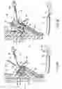 Fig. 07 - Endoscope accessory, endoscope system and method for mounting endoscope accessory to endoscope