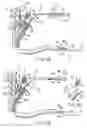 Fig. 11 - Endoscope accessory, endoscope system and method for mounting endoscope accessory to endoscope