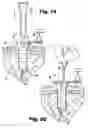 Fig. 07 - Surgical access instruments for use with delicate tissues