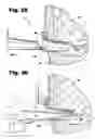 Fig. 10 - Surgical access instruments for use with delicate tissues