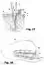 Fig. 11 - Surgical access instruments for use with delicate tissues