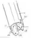 Fig. 01 - Surgical retractor extensions