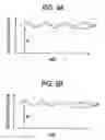Fig. 08 - Signal processing method, and pulse photometer using the method