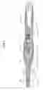 Fig. 10 - Catheter with contractable mapping assembly