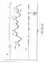 Fig. 33 - Method of determining cardiac indicators