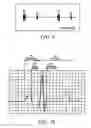 Fig. 08 - Method for detecting heart rate and systems thereof