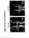 Fig. 06 - Administration of therapeutic or diagnostic agents using interlabial pad