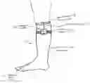 Fig. 01 - Medical compression devices and methods