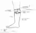 Fig. 02 - Medical compression devices and methods