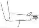 Fig. 01 - Protective cast cover