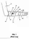 Fig. 02 - Protective cast cover