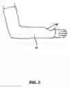 Fig. 04 - Protective cast cover
