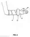 Fig. 07 - Protective cast cover