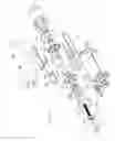 Fig. 07 - Hyperthermia treatment and probe therefor