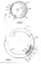 Fig. 04 - Ablation catheter with fluid distribution structures