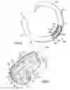 Fig. 06 - Ablation catheter with fluid distribution structures