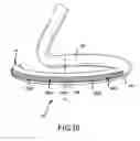 Fig. 11 - Ablation catheter with fluid distribution structures