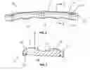 Fig. 03 - Anterior cervical plate