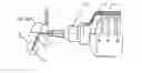 Fig. 01 - Method for eye refractive surgery and device for implanting an intraocular refractive lens