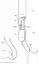 Fig. 01 - Single catheter mitral valve repair device and method for use
