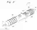 Fig. 03 - Single catheter mitral valve repair device and method for use