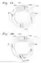 Fig. 05 - Single catheter mitral valve repair device and method for use