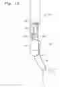 Fig. 11 - Single catheter mitral valve repair device and method for use