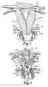 Fig. 02 - Devices and Methods for Ligating Uterine Arteries
