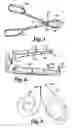 Fig. 03 - Devices and Methods for Ligating Uterine Arteries