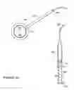 Fig. 03 - Device, system, and method for epithelium protection during cornea reshaping