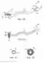 Fig. 02 - Apparatus and methods for endoluminal advancement