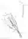 Fig. 02 - Apparatus and methods for intravascular embolic protection