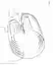 Fig. 03 - Apparatus and methods for intravascular embolic protection
