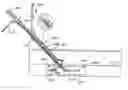 Fig. 01 - Interventional medical closure device