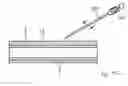 Fig. 07 - Interventional medical closure device