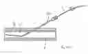 Fig. 09 - Interventional medical closure device