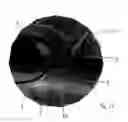 Fig. 15 - Interventional medical closure device