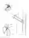 Fig. 16 - Interventional medical closure device