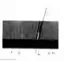 Fig. 26 - Interventional medical closure device