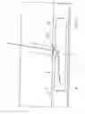 Fig. 47 - Interventional medical closure device