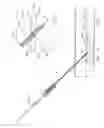 Fig. 55 - Interventional medical closure device