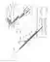 Fig. 57 - Interventional medical closure device