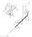 Fig. 60 - Interventional medical closure device